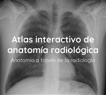 Atlas interactivo anatomÍa radiológica