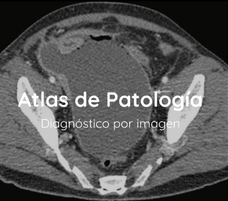 Atlas de patología diagnostico por imagen