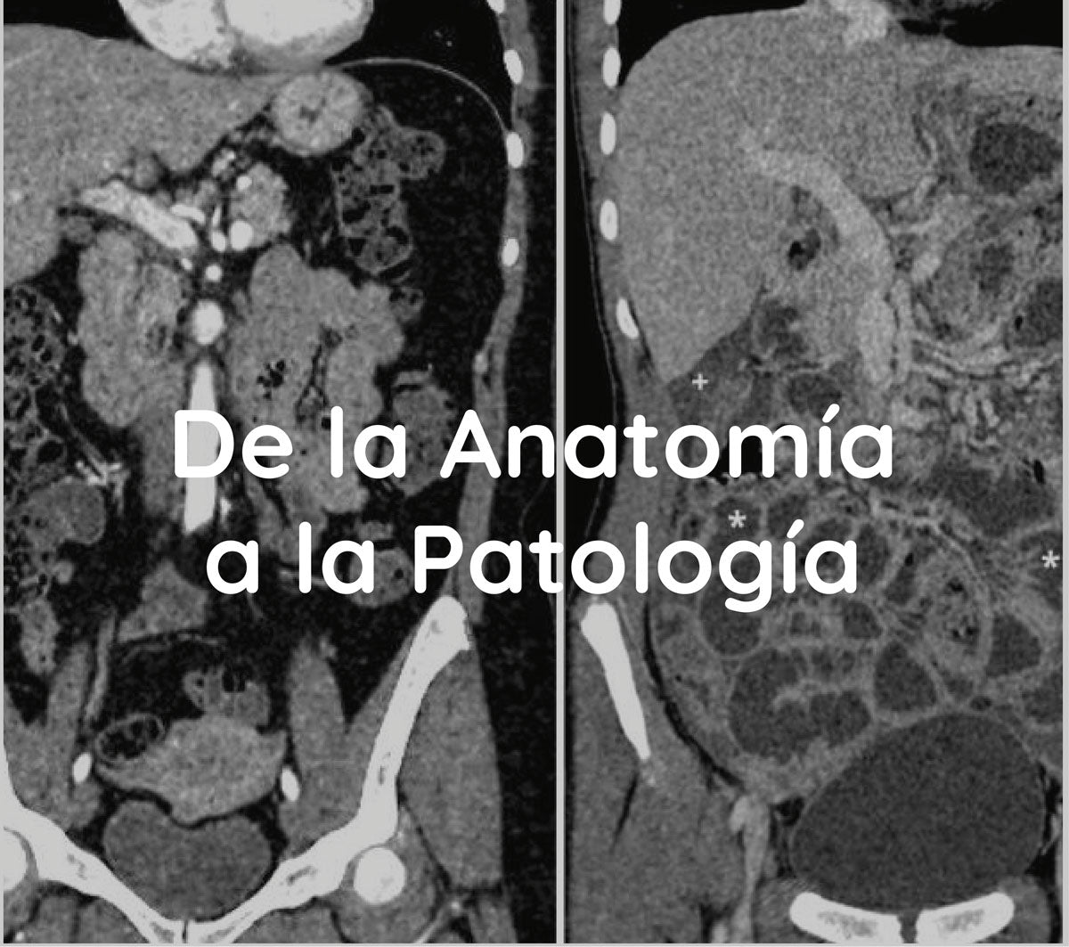 Pack 2 Atlas + BONUS Atlas de la Anatomía a la patología